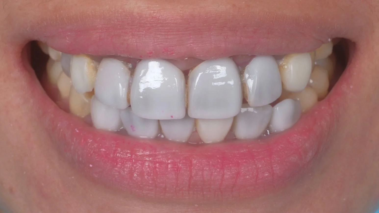 icare dental_website_Smile make over icare dental_website_Smile make over